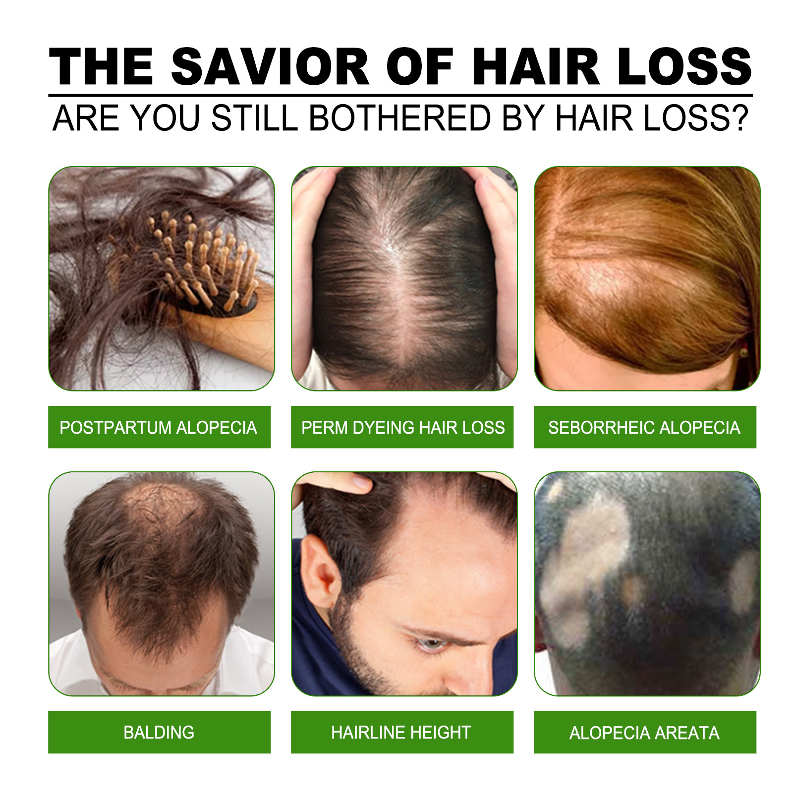 Fast Ginger Hair Growth Spray  - Hair Care For Hair Loss review and price