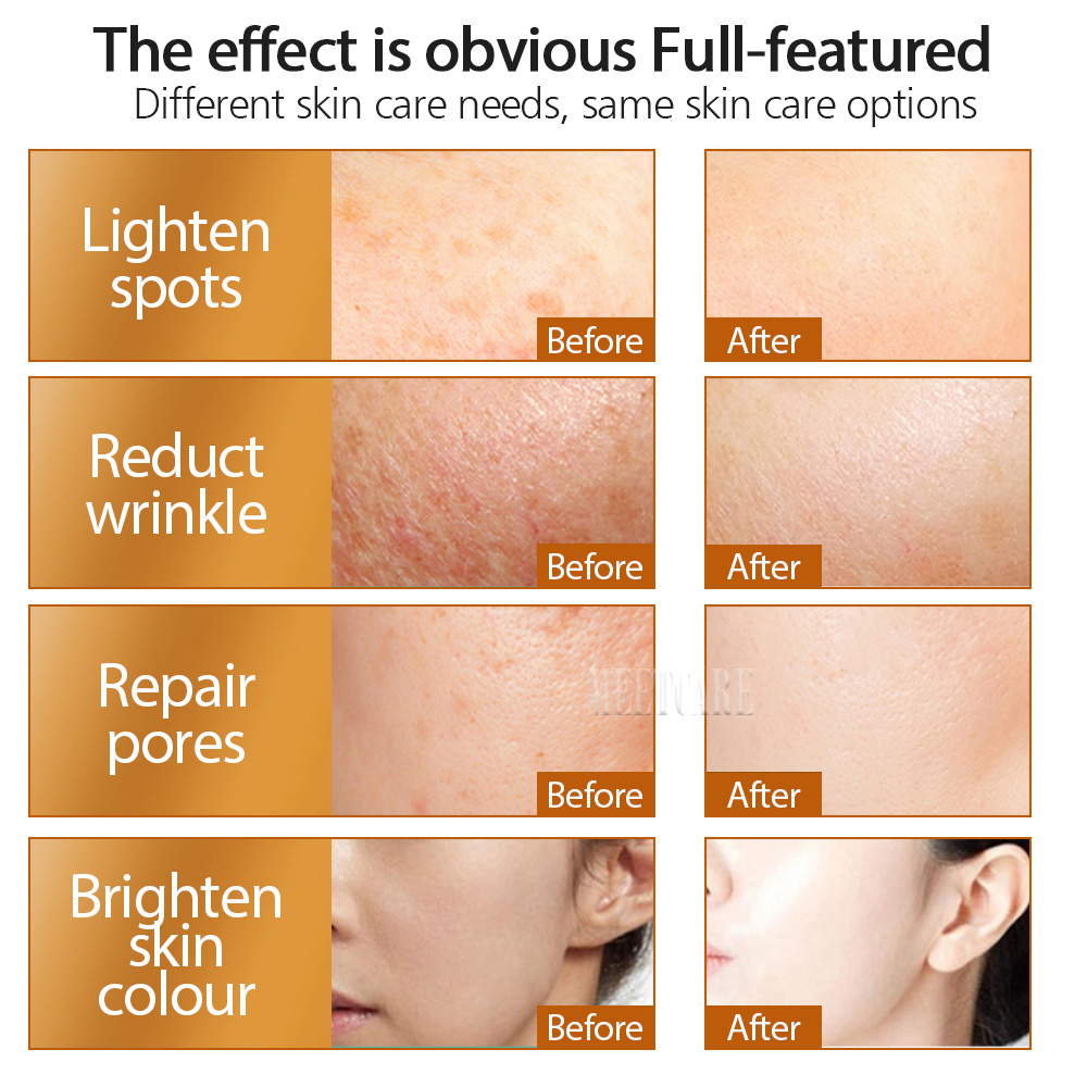 ZGTS 192pin Derma Roller Micro - Hair Care Tips review and price
