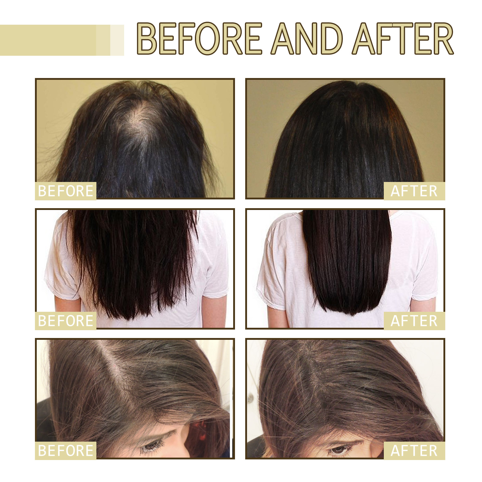 Rosemary Hair Growth Oil 60ml  - Hair Care For Hair Loss review and price