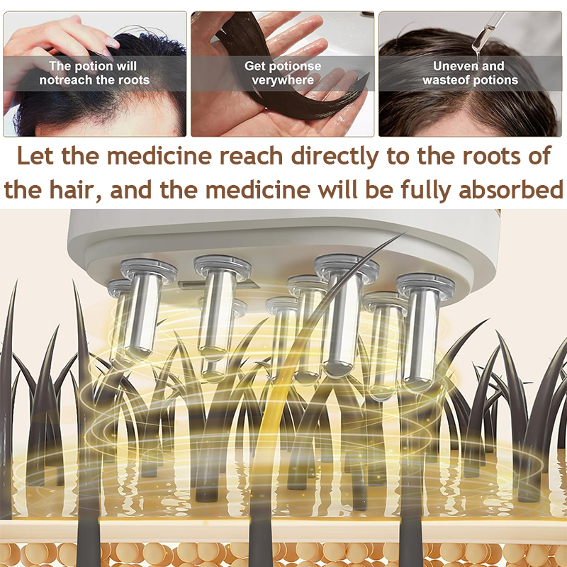 Electric Scalp Massager Portab - Hair Care For Hair Loss review and price