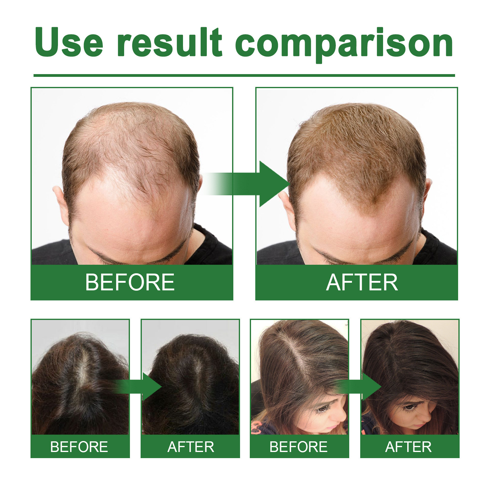 Rosemary Spray for Hair Nouris - Hair Care For Hair Loss review and price