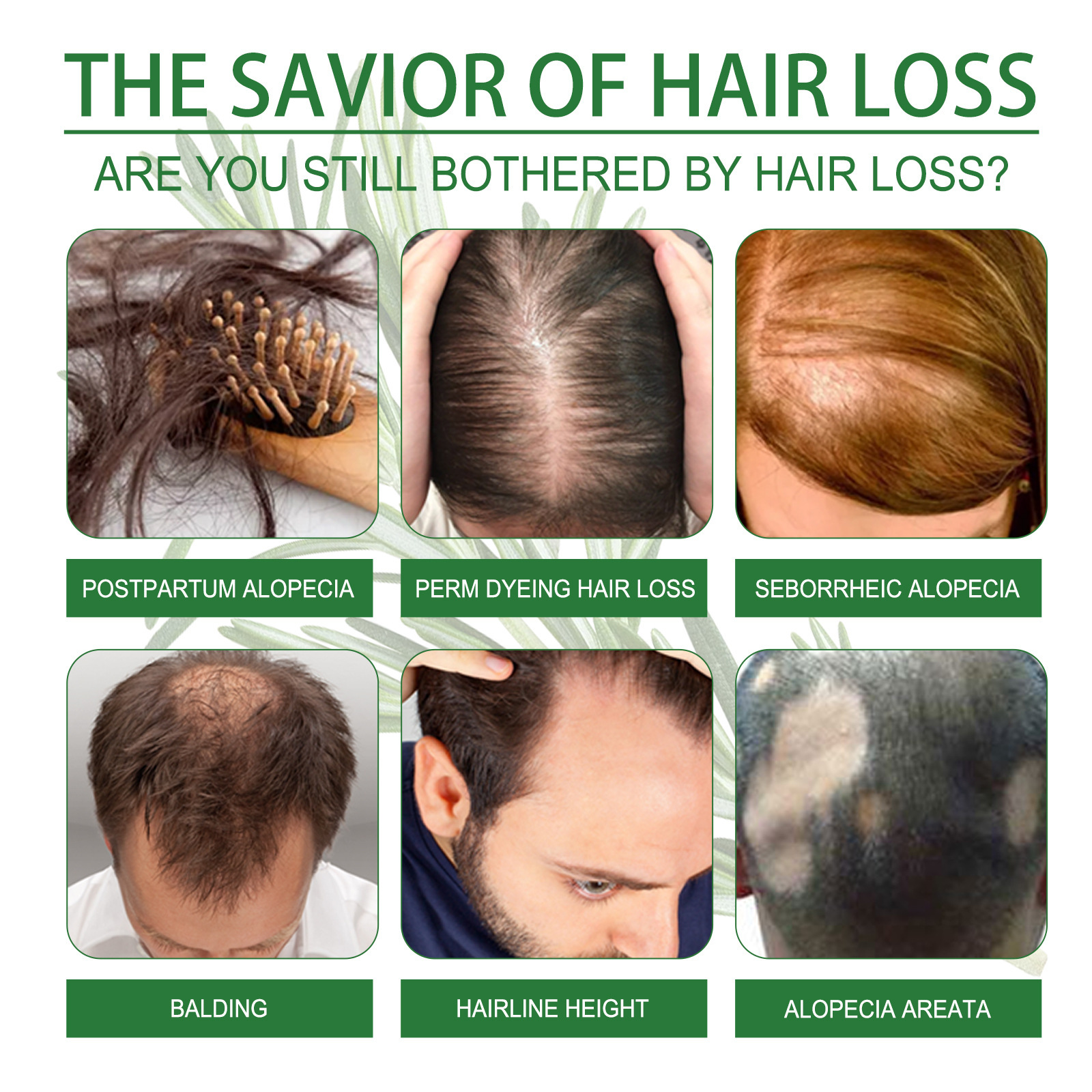 Rosemary Spray for Hair Nouris - Hair Care For Hair Loss review and price